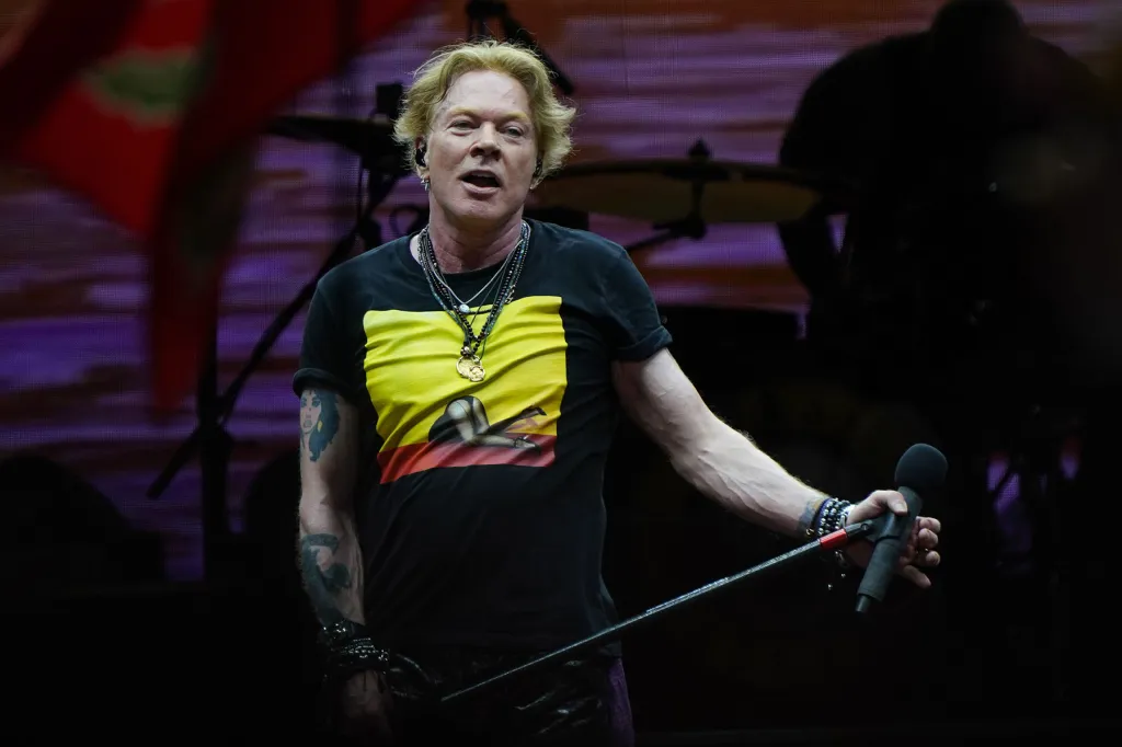 Axl Rose révèle son problème avec l'ATM : "On dirait que ma mâchoire va tomber"